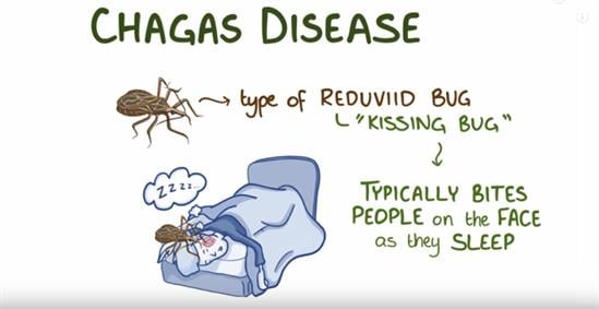 Chagas-disease-causes-symptoms